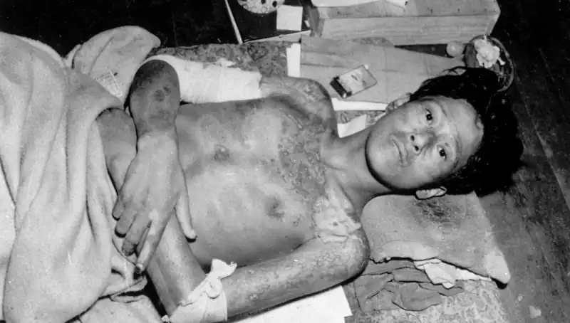 80 Yıldan Sonra Nagasaki'den Gelen Uyarı: Nükleer Tehdit Artıyor!